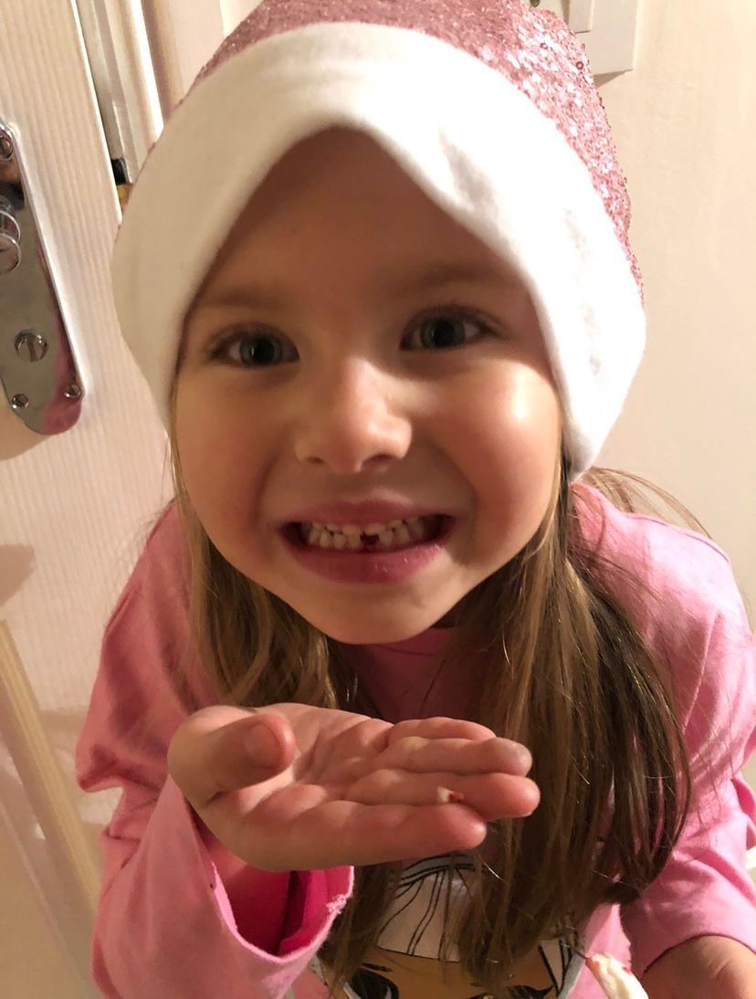 Jennifers daughter Emmy losing her first tooth