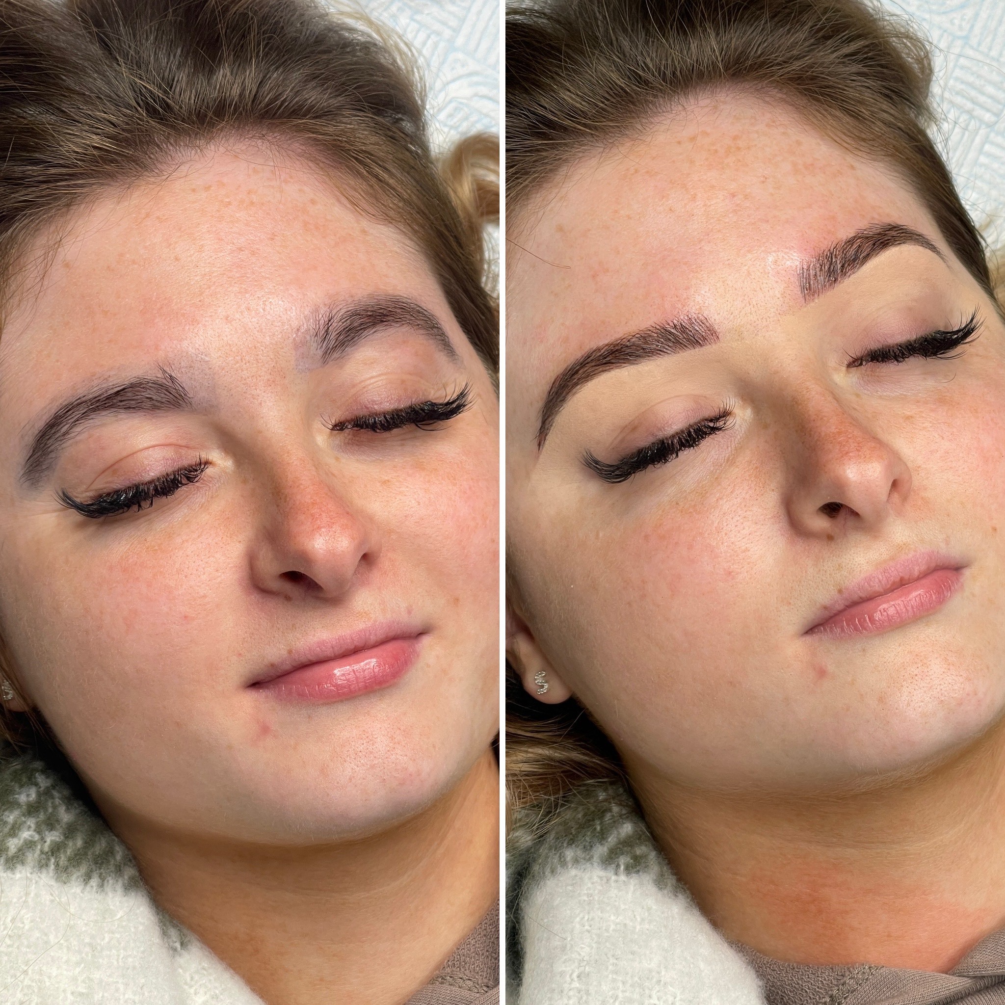 Eyebrow treatment